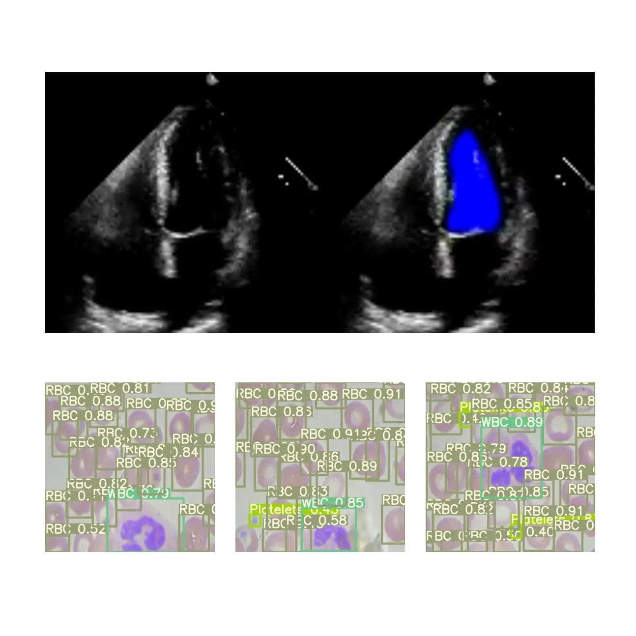 AI Imaging System