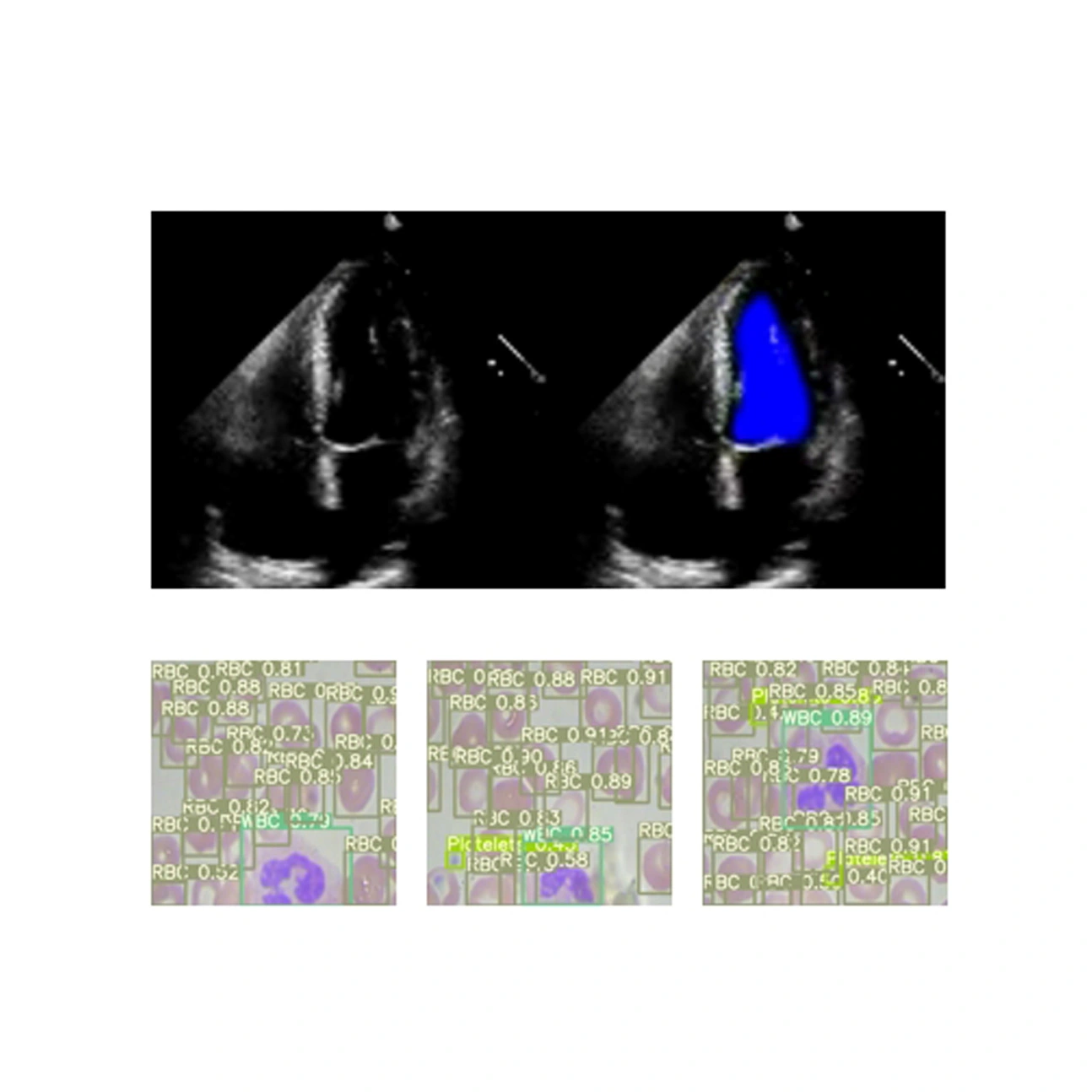 AI Imaging Analysis System